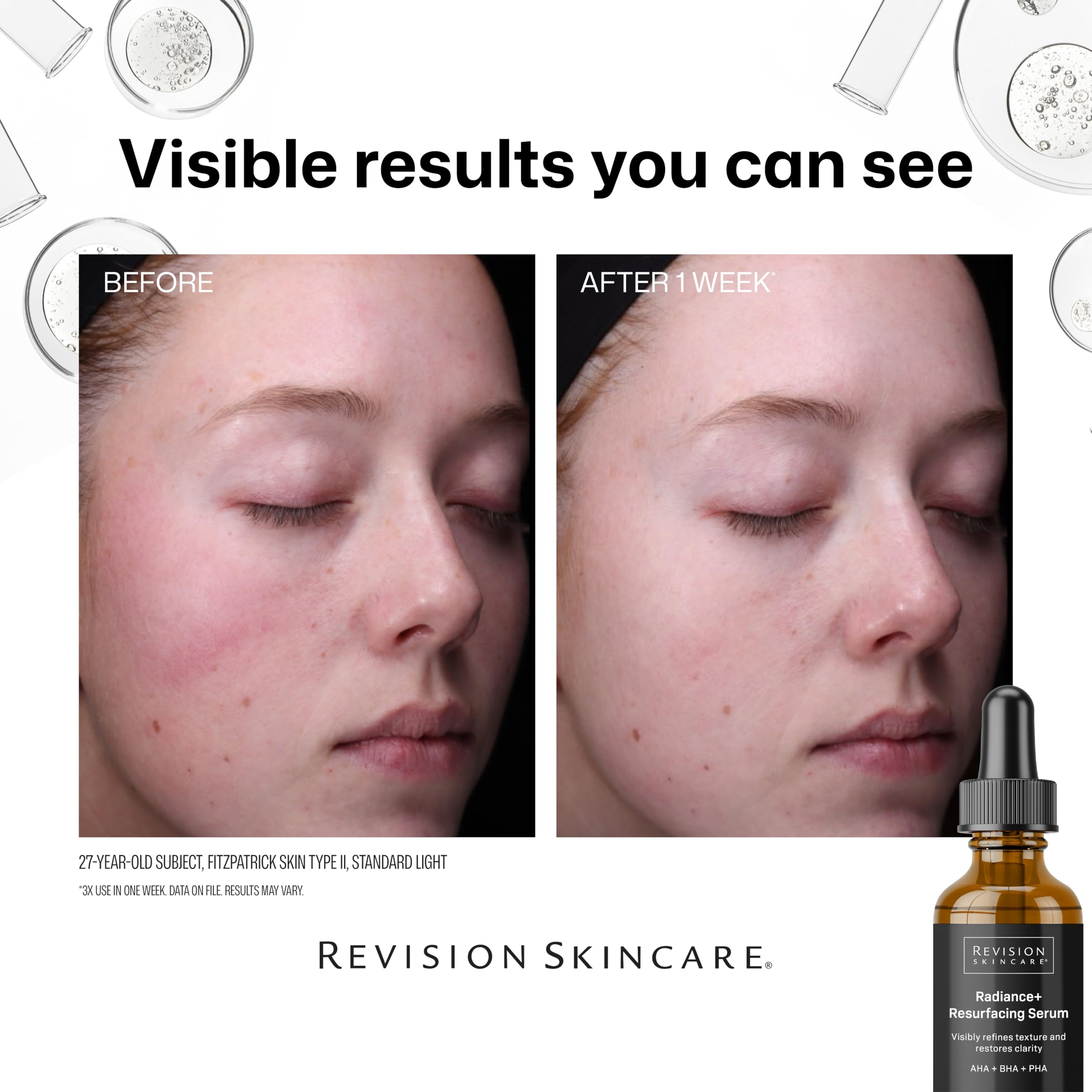 Revison Skincare Radiance+ Resurfacing Serum, Overnight AHA+BHA+PHA Exfoliating Serum with Glycolic Acid & Salicylic Acid | Smooths Uneven Texture, Clears Pores & Brightens Dull Skin