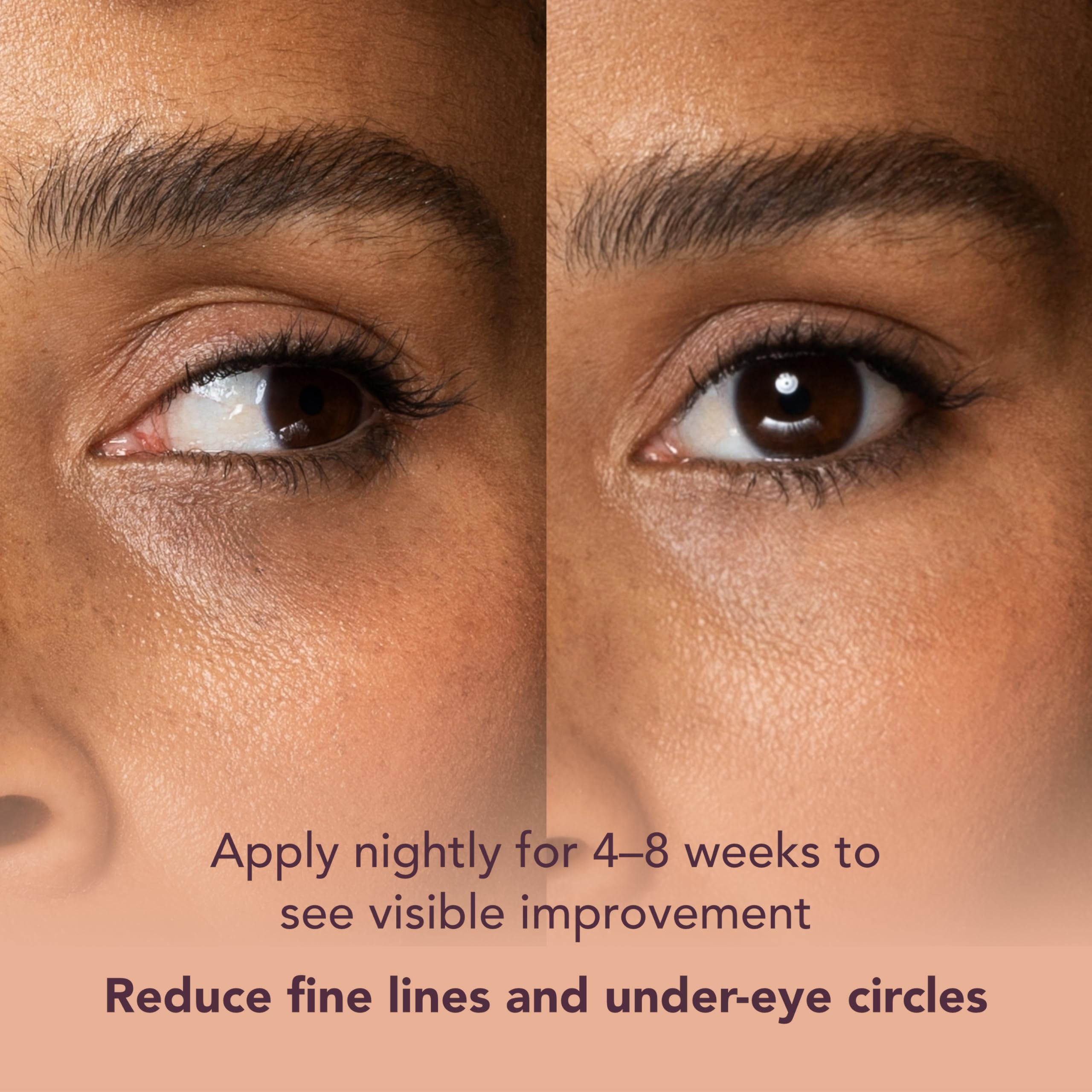 Crema de ojos coreana con retinol para ojeras e hinchazón, arrugas, líneas finas, crema antienvejecimiento de noche debajo de los ojos, niacinamida, raíz de cúrcuma, 6 tipos de ceramidas, ácido 6