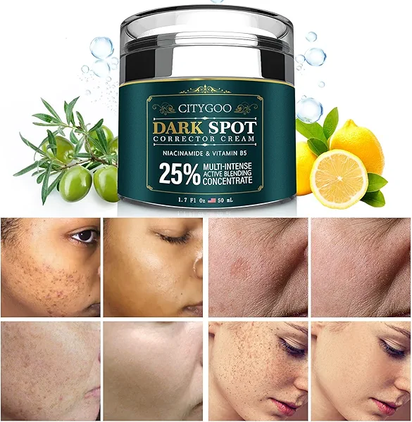 CITYGOO Dark Spot Remover for Face: Dark Spot Corrector Cream - Enriching Skin Care For All Skin Tones - Melasma Freckle Sun Spot Remover & Blemish Reducer-1.7 FL OZ