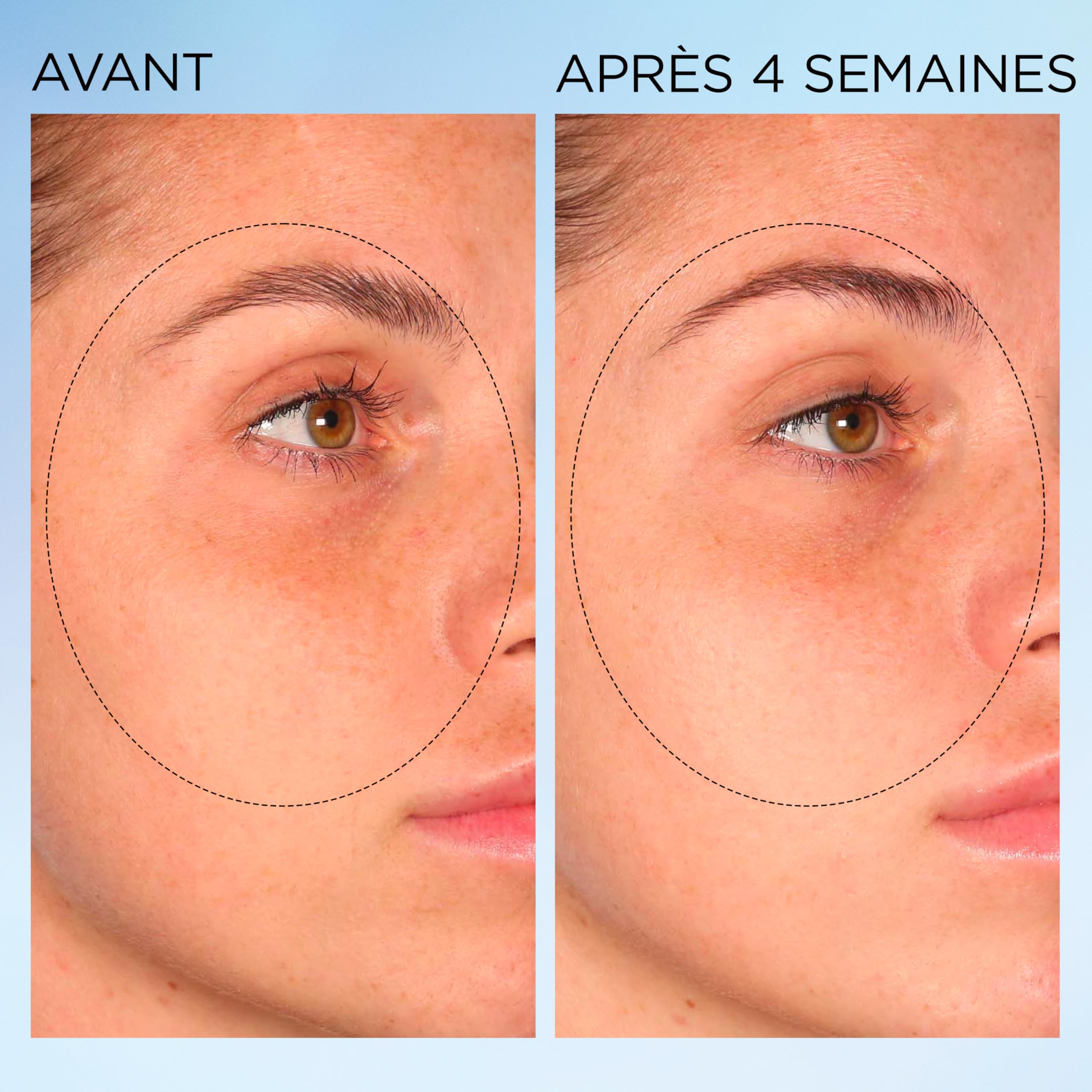 Elizabeth Arden, Visible Brightening Capsules Sérum Correctrices Anti-taches Booster d’Éclat, Serum visage, Soin skincare anti taches brunes, Lisse le teint, Eclat