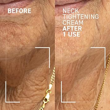 Dr. Brandt Needles No More Neck Tightening Cream - Lifts, Tightens & Reduces Skin Sagginess - Includes a Rose Quartz Gua Sha Tool - 1.7 oz