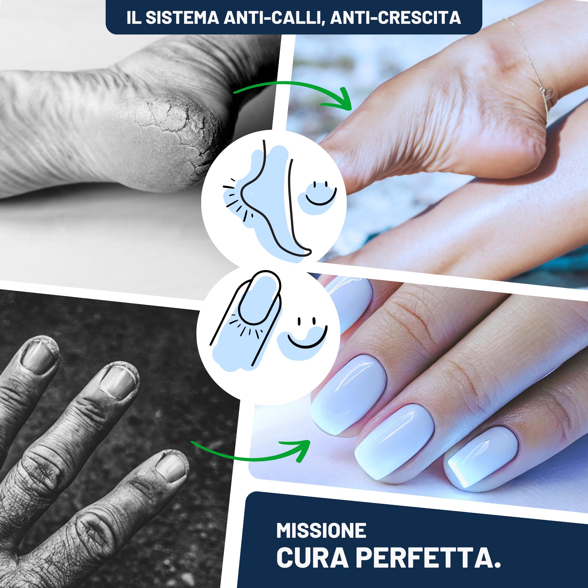 Mr. Fuss No. 1 Soluzione, Calli Piedi Rimozione, Plus Pack Basic Standard, Kit Callifugo Per Piedi, 3 Parti, Liquido Cheratolitico Extra Forte