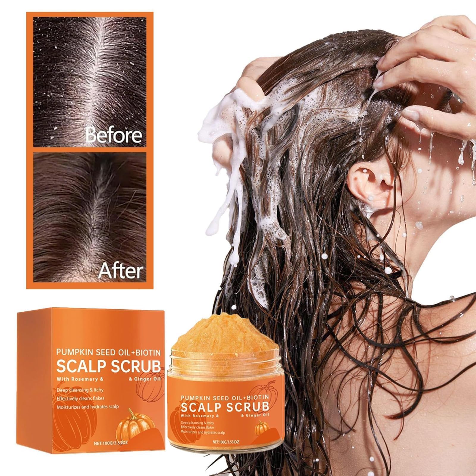 Exfoliante natural para el cuidado del cuero cabelludo, alivia la picazón y la caspa, limpieza profunda e hidratación, combate la caspa y elimina residuos, apto para cuero cabelludo graso y seco