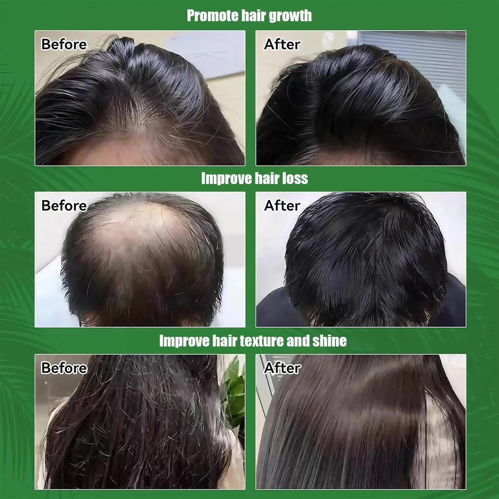 Raw Batana Oil Paste for Hair Growth, 100% Batana Oil from Honduras, Pure Hair Treatment Repairs Damage - Image 3