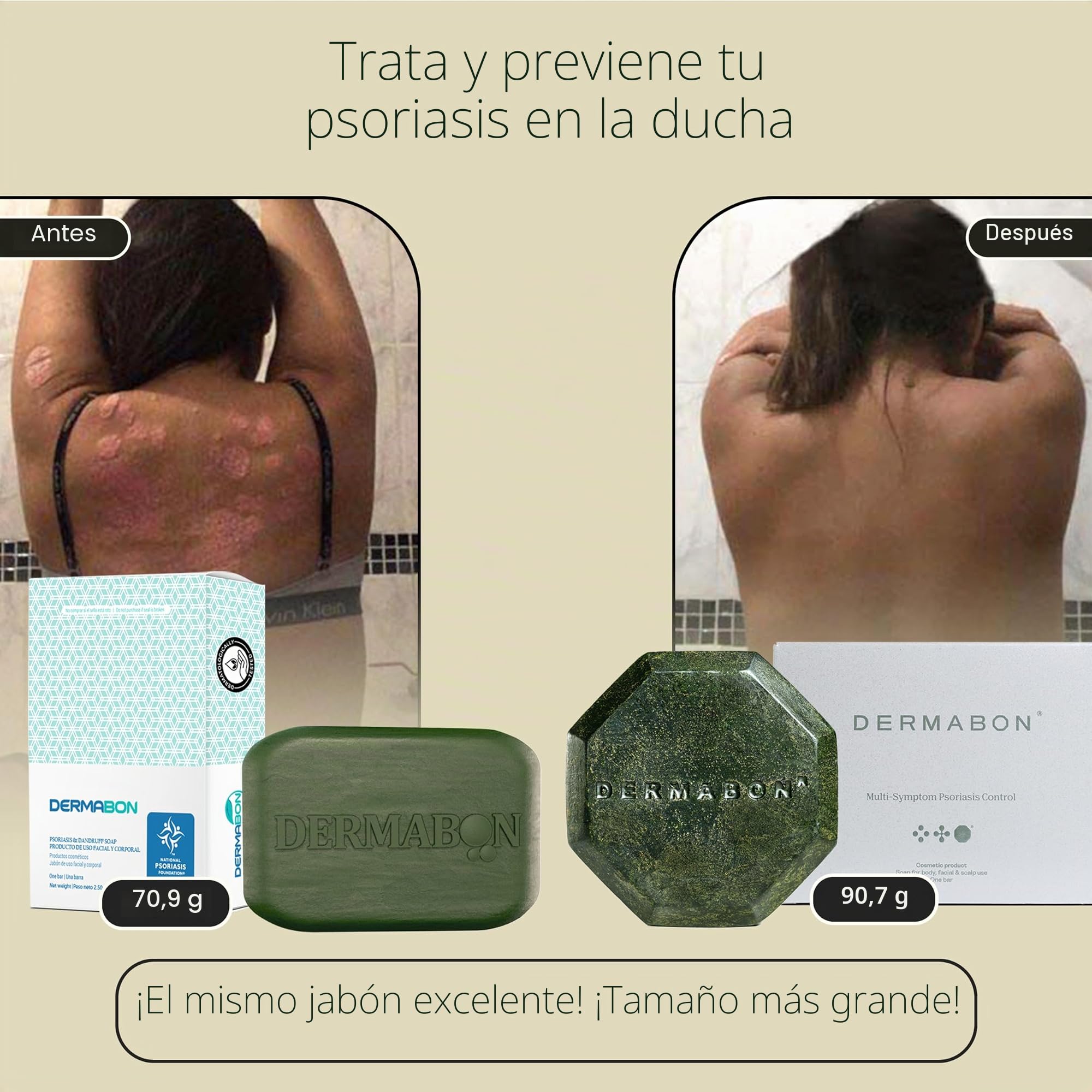 Dermabon Jabón limpiador de psoriasis, dermatitis seborreica y eccema para adultos, 2% de jabón de alquitrán de hulla, alivia la picazón, reduce la inflamación, hidrata la piel, uso diario suave,