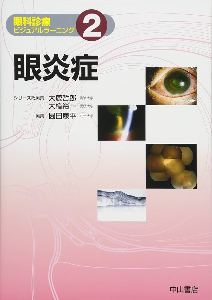 眼炎症 (眼科診療ビジュアルラーニング) | 園田康平 |本 | 通販