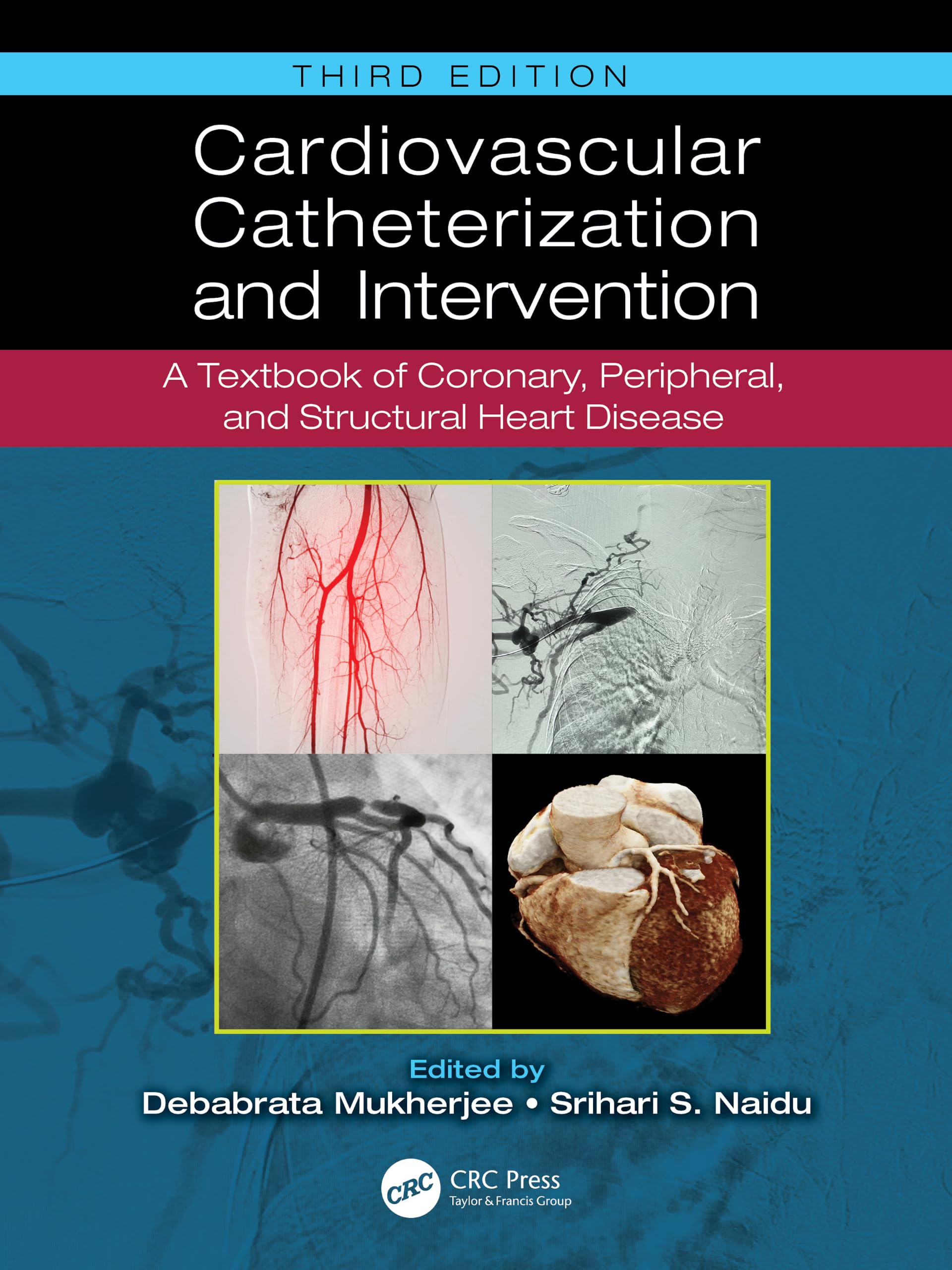 Cardiovascular Catheterization and Intervention by Debabrata ... - 9781032823263