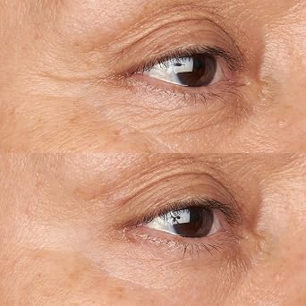 Perricone MD Hypoallergenic Clean Correction Firming & Brightening Eye Cream