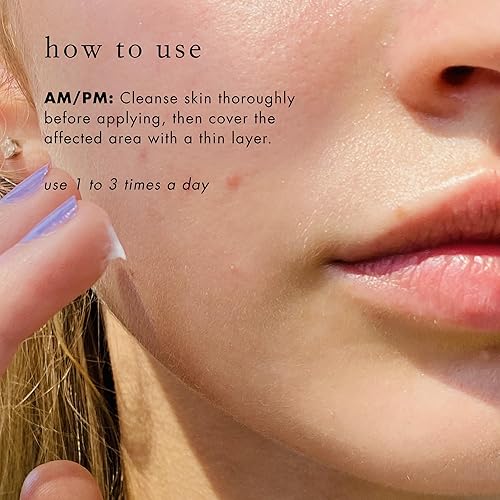 Miniatura 5 de Bioelements Breakout Control - 1 onza líquida - Tratamiento de manchas de acné con peróxido de benzoilo al 5% para piel propensa al acné, mixta y