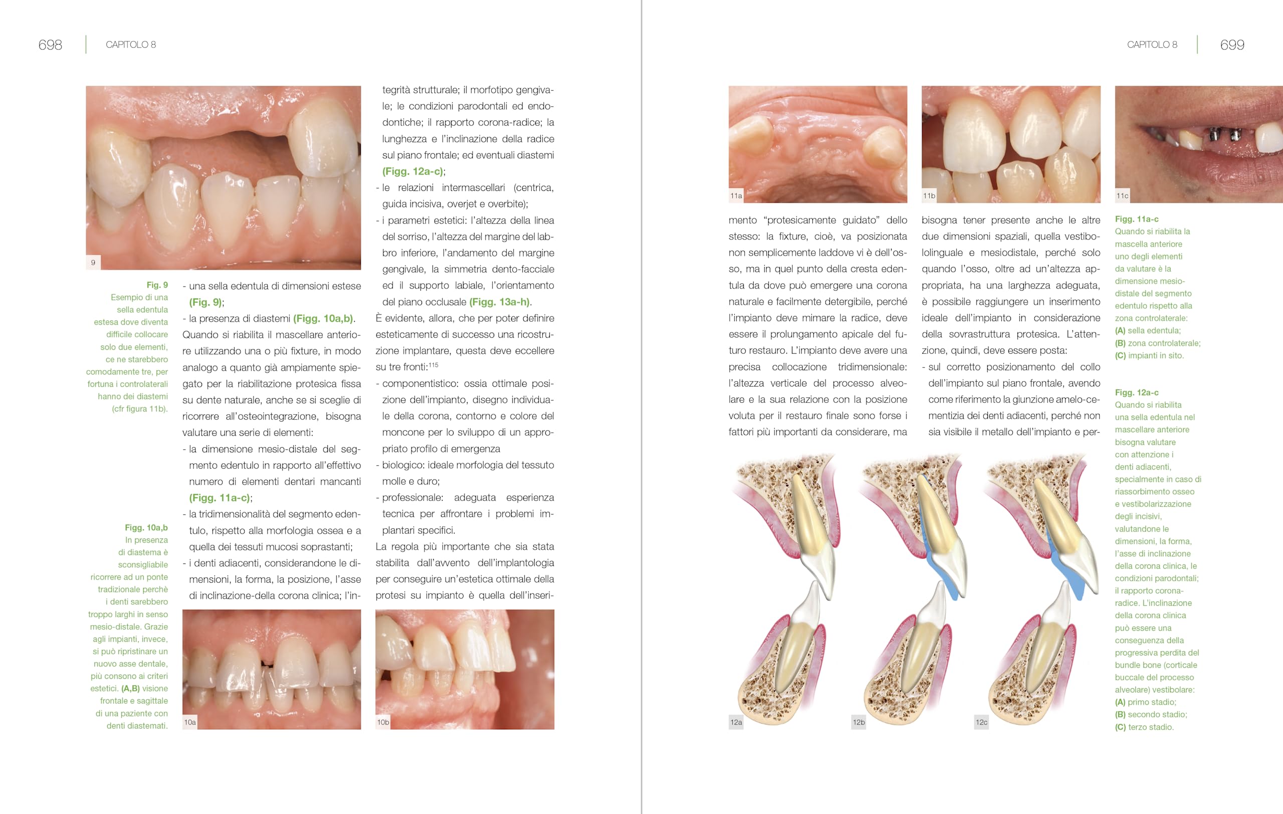 Bioestetica nella riabilitazione orale