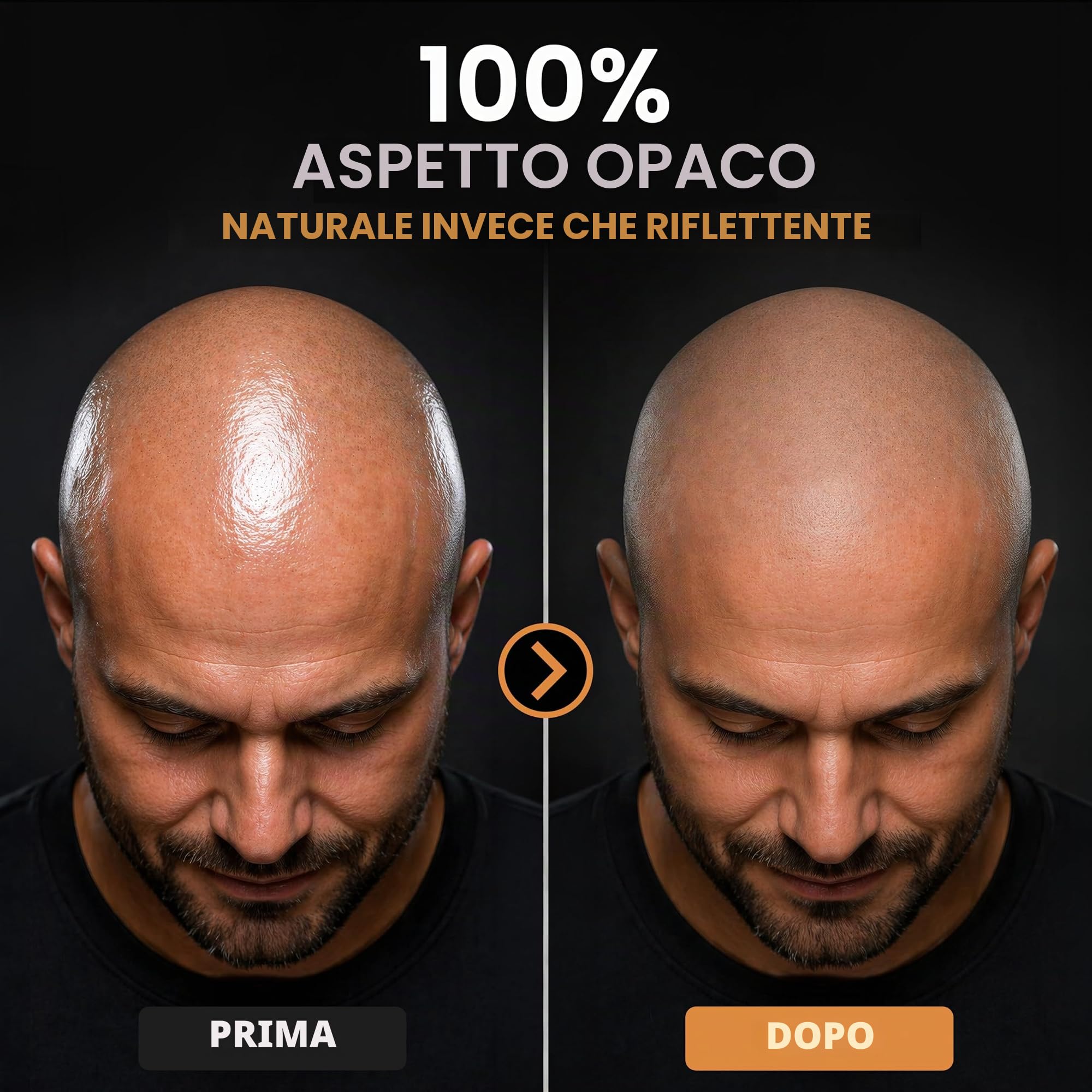 Anti-Shine Crema Calvizie Nutriente Opacizzante Idratante 74 g