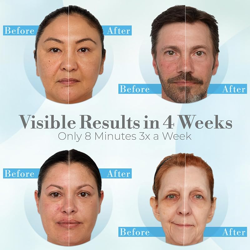 iDerma Red Light Therapy for Face – LED Face Mask for Eyes, Neck & Skin | Infrared Therapy Mask for Anti-Aging, Wrinkles, Skin Rejuvenation image 2