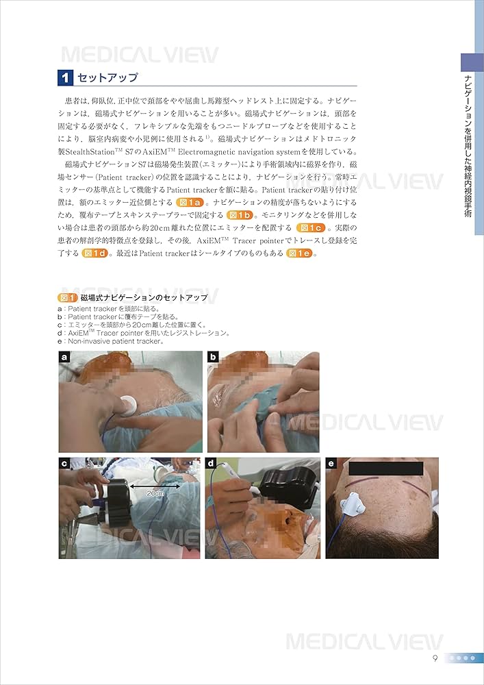 脳神経外科 新NS NOW12 脳神経外科低侵襲手術の今 新NS NOW｜定期購読 - 雑誌のFujisan