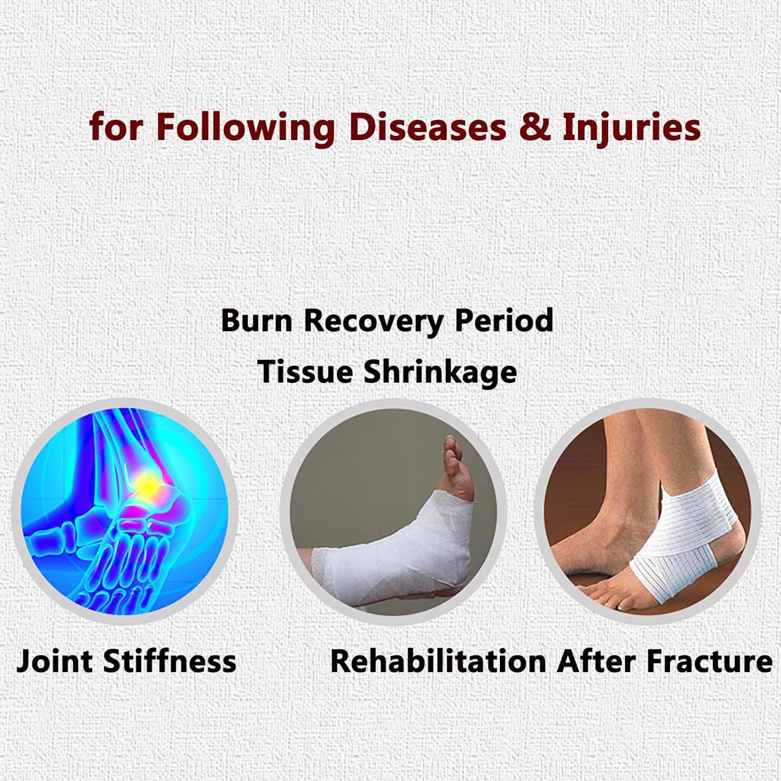 Entrenador de rehabilitación de tobillo, fuerza y ángulo ajustables, corrección de estiramiento estático para dislocación y recuperación de lesiones de ligamentos