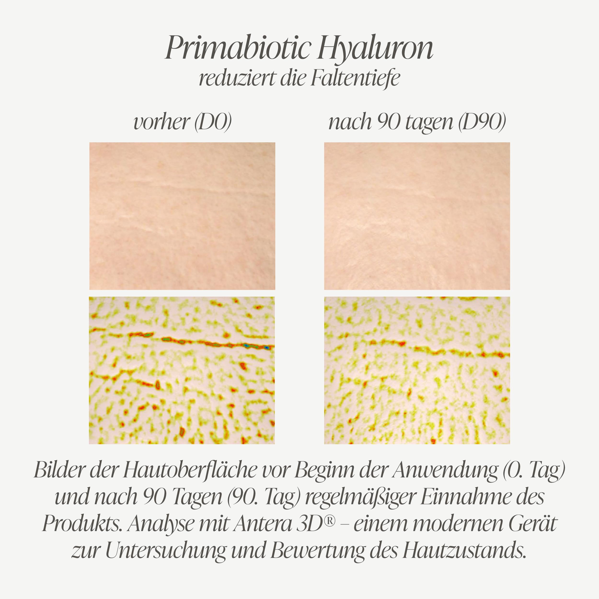 Kollagen Trinkampullen – Primabiotic Collagen Peptide 10000 mg | 30 Ampullen à 30 ml (900 ml + Hyaluronsäure Trinkampullen – Primabiotic Hyaluron 250 mg | 30 Shots à 30 ml (900 ml)