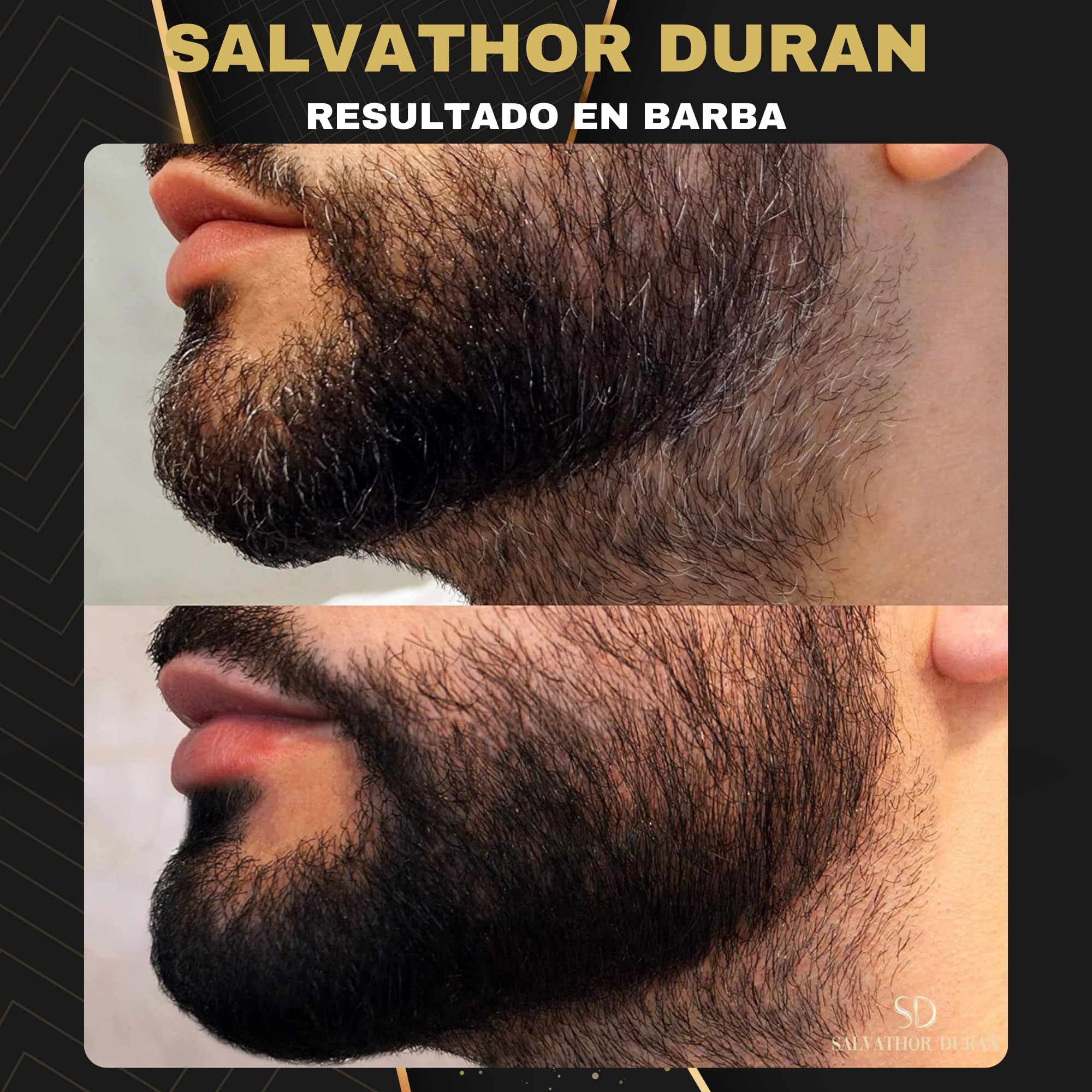 Tinte Barba Hombre - Tinte Barba - Champu Anticanas Hombre - 20 Aplicaciones - Con Protector de Barba - Salvathor Duran - 250 ml.