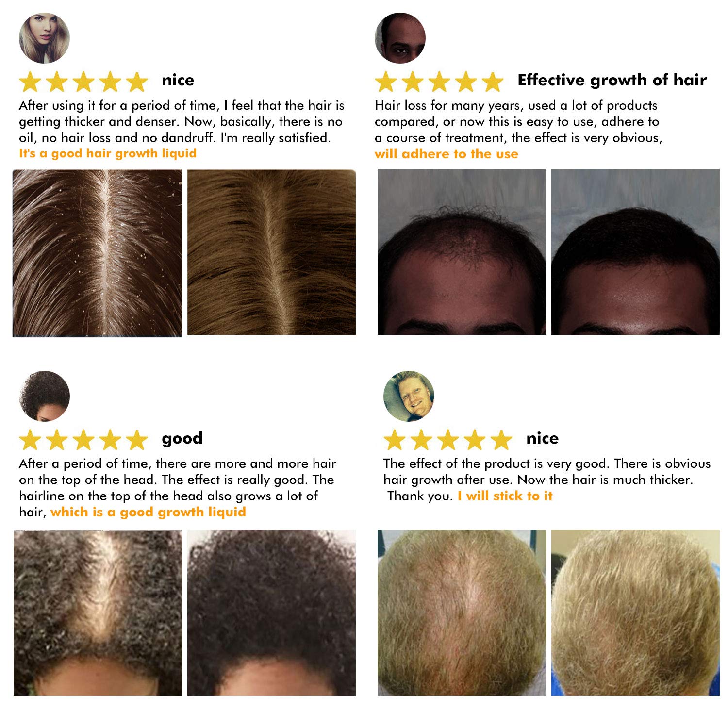 Buy Derma Roller for Hair Growth, Biotin Hair Growth Oil Serum, Hair