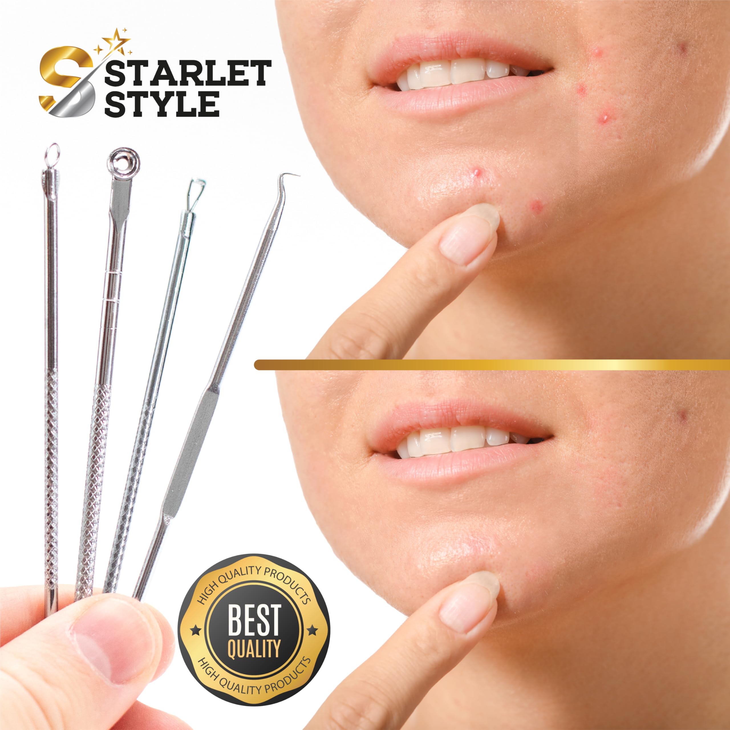 Aspiratore Punti Neri Professionale, Blackhead Remover con 5 Testine, Pulizia Viso Profonda, Rimozione Punti Neri Naso e Porri Dilatati, Kit Pulizia Elettrico USB