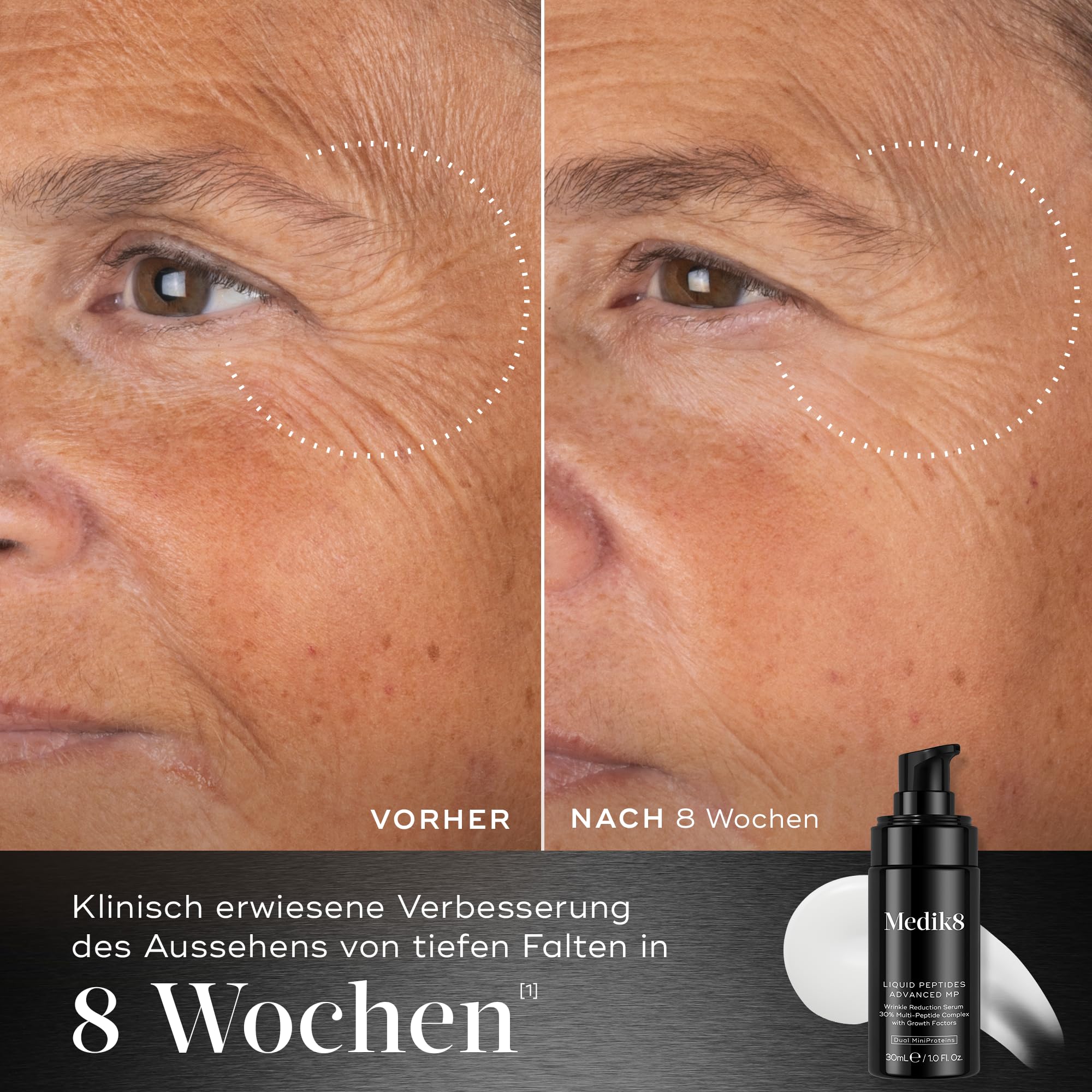 Medik8 Liquid Peptides Advanced MP, Bahnbrechende Bio-Technologie - 30 ml | Serum zur Faltenreduzierung mit 30 % Multi-Peptid-Komplex – nachweisliche Ergebnisse in nur 10 Minuten