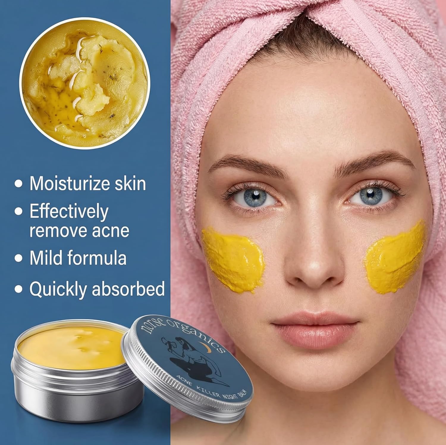 Acne & Redness Care Balm, Botanical Face Moisturizer for Blemish Prone Skin, Natural Plant Formula Oil Control & Pore Care Cream, Suitable for All Skin Types, 1PCS