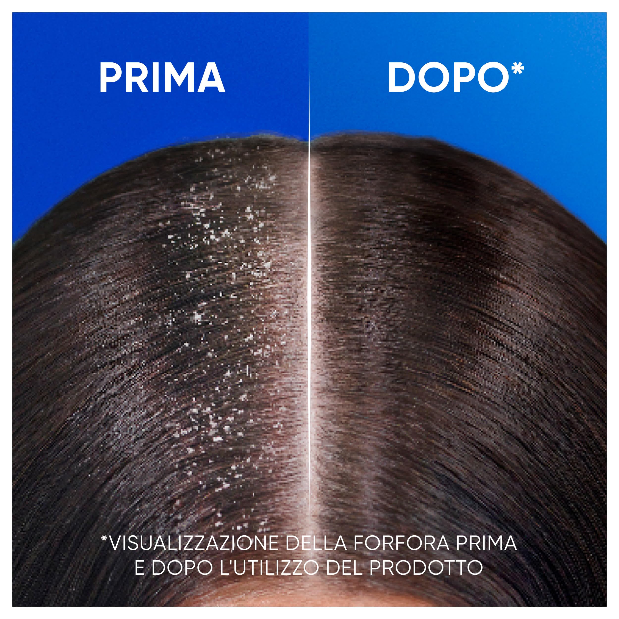 Head & Shoulders Shampoo Antiforfora Citrus Fresh, Per Capelli Grassi, Fino Al 100% Protezione Dalla Forfora Per Cute E Capelli, Dermatologicamente Testato, Formato Maxi Convenienza 2x1000ML