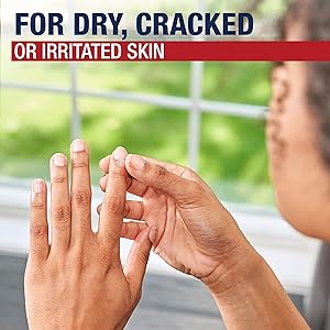 Aquaphor Healing Ointment Advanced Therapy Skin Protectant, Dry Skin Body Moisturizer, 7 Oz Tube