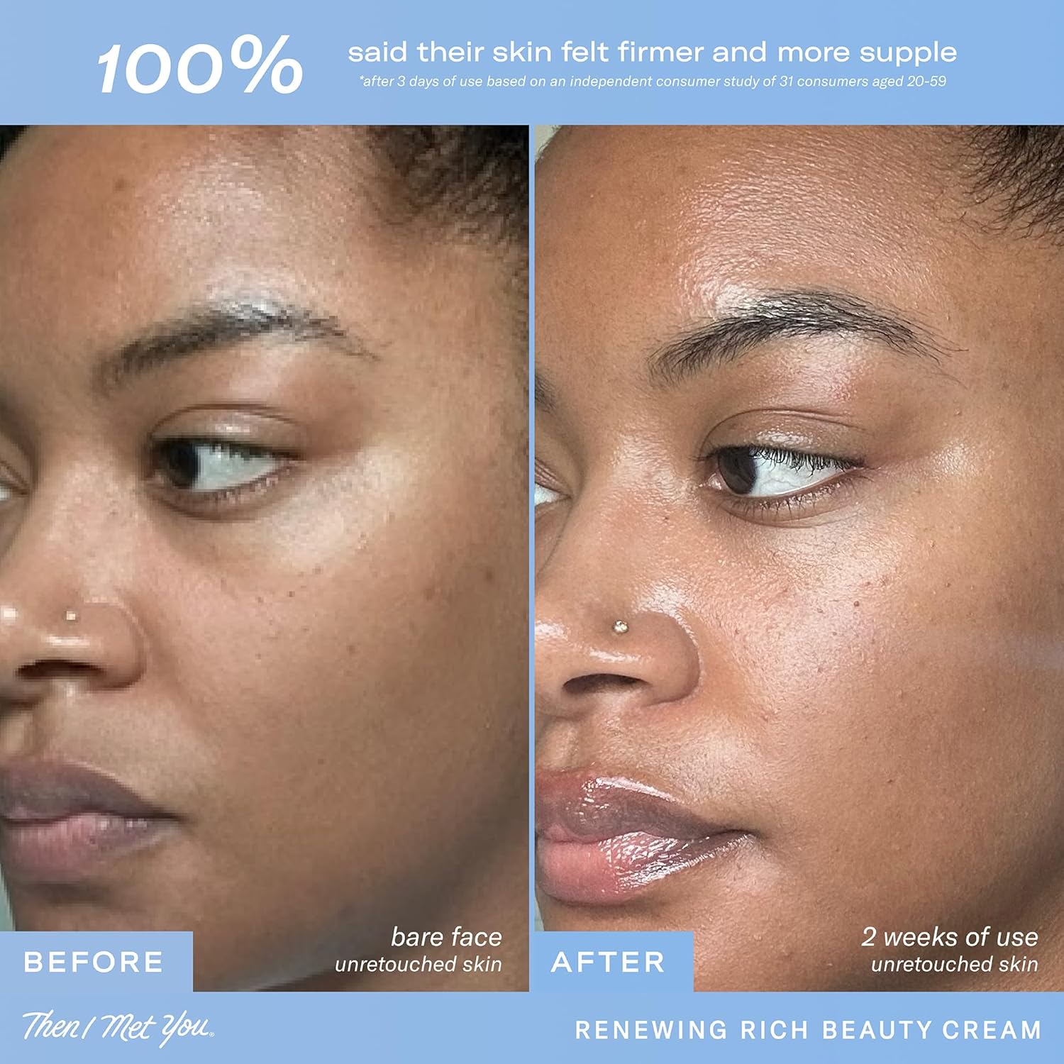 Then I Met You Renewing Rich Beauty Cream – Rich and Silky Moisturizer for Face with Ginseng + Squalane – Vegan, Clean Skincare (1.69 fl oz) em promoção! Veja a oferta e mais achadinhos de Natural, Vegano & Clean Beauty 4 Hoje é o melhor dia para comprar Then I Met You Renewing Rich Beauty Cream – Rich and Silky Moisturizer for Face with Ginseng + Squalane – Vegan, Clean Skincare (1.69 fl oz) com aquele preço maroto! Promoção! Aproveite a oferta! 4