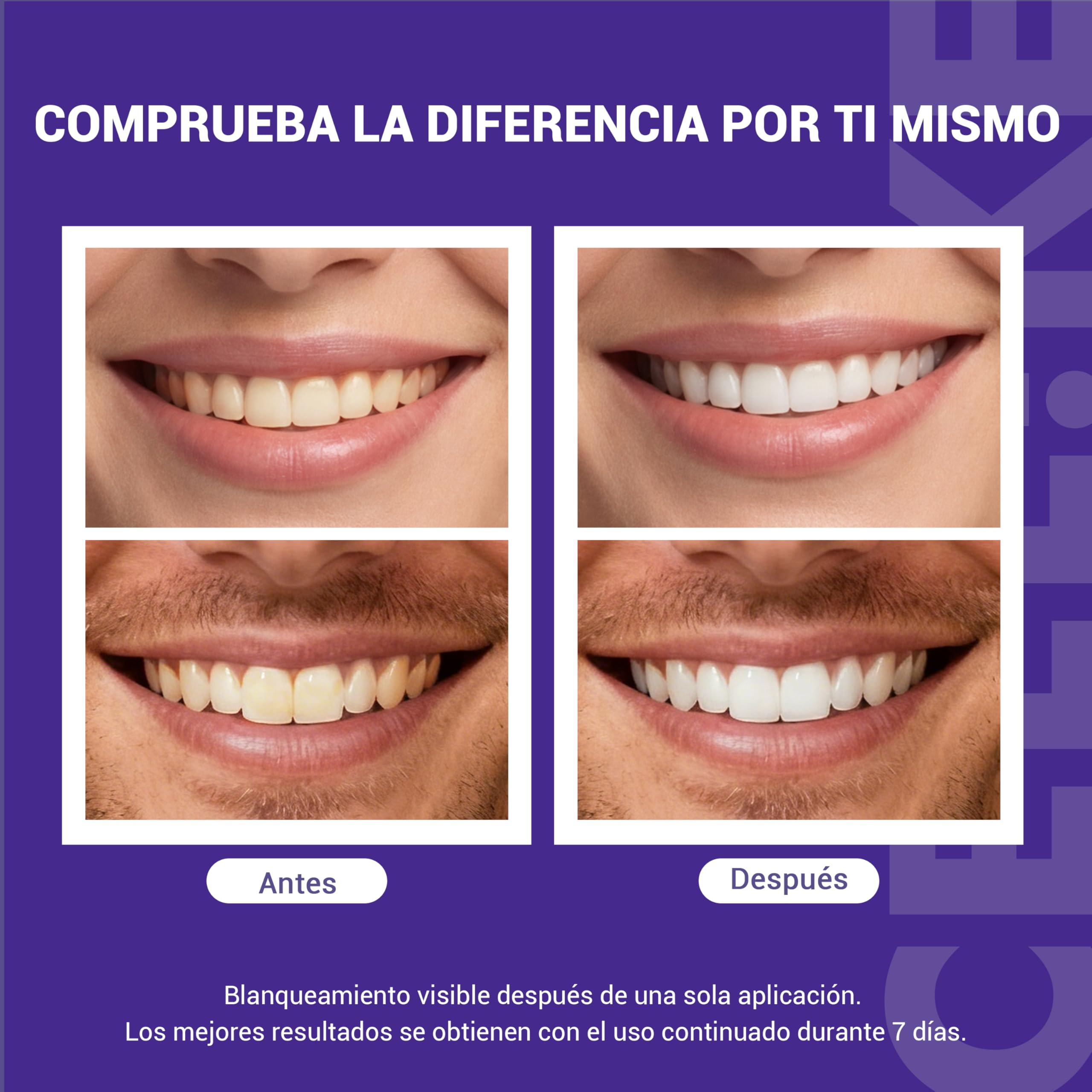 CEELIKE Tiras blanqueadoras moradas para dientes - Fórmula con PAP + nHAP - Tecnología correctora de color violeta - 14 tiras (7 usos) - Aptas para dientes sensibles — view 2