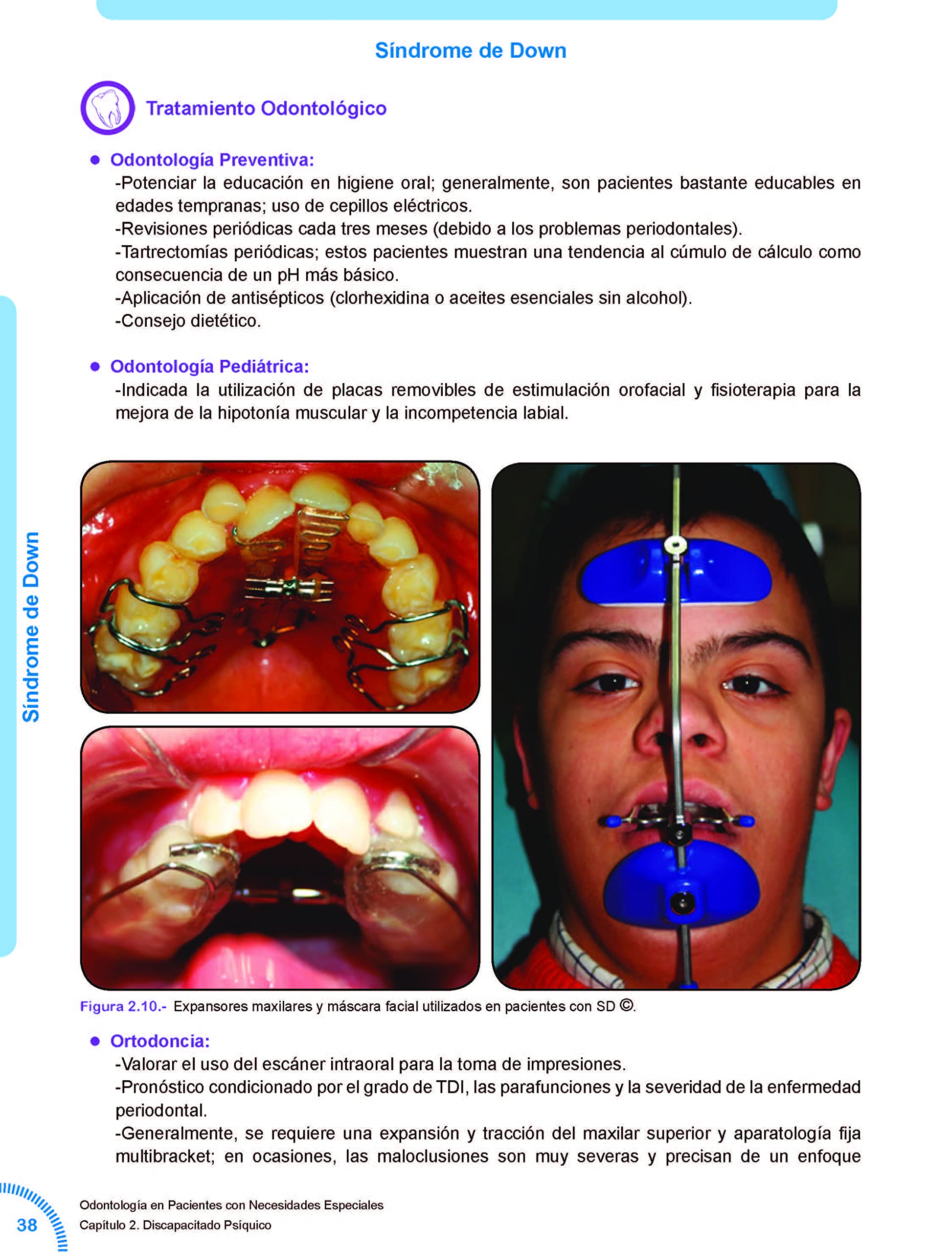 Odontología en pacientes con Necesidades Especiales