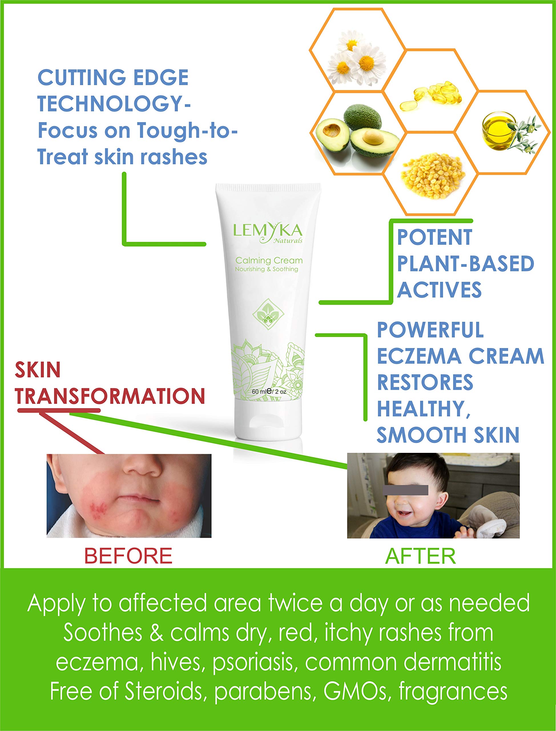 Buy LEMYKA Eczema Flare Defense Natural Calming Cream 3 Pack Bundle