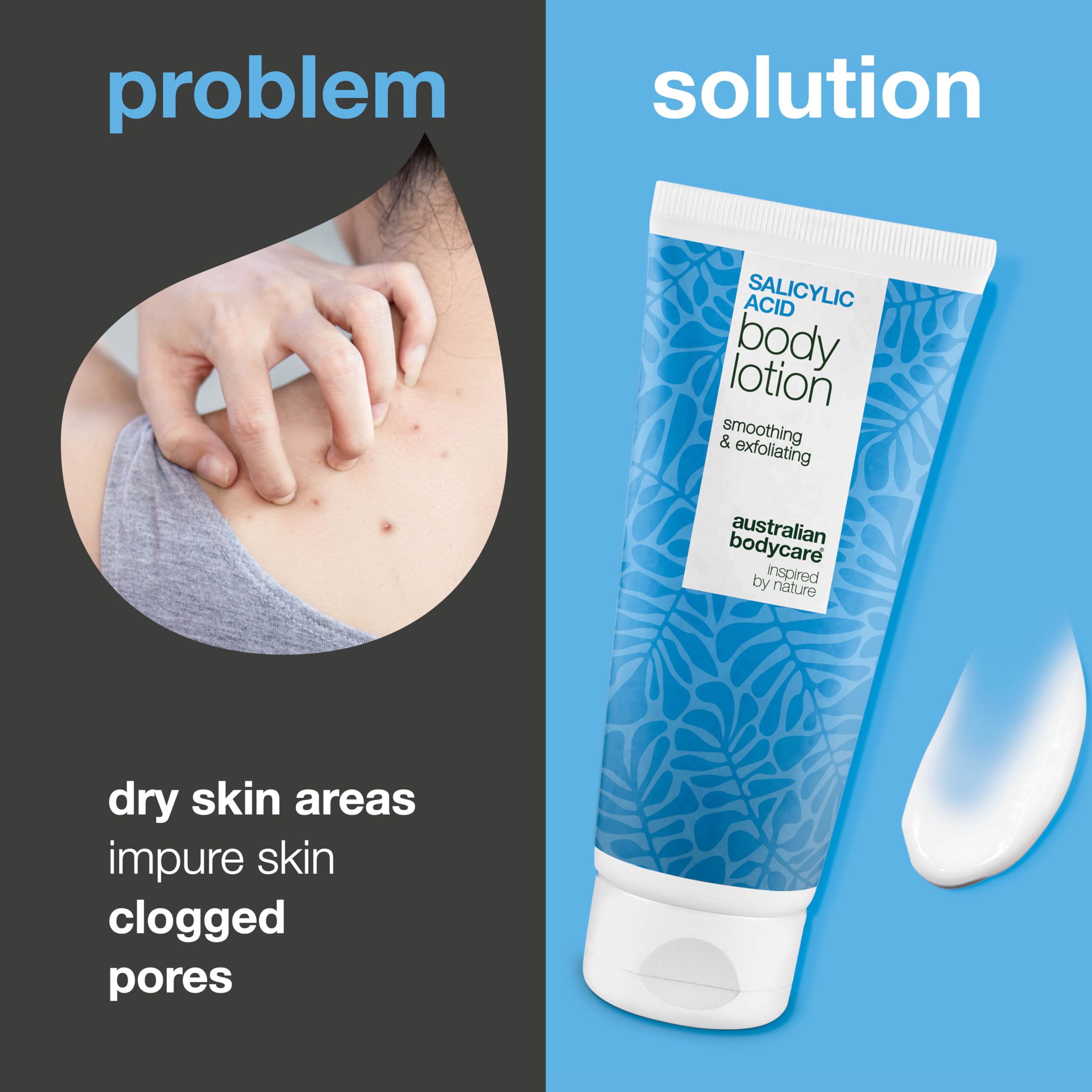 Body lotion with salicylic acid 200 ml, fights blemishes, dry and oily skin. With BHA, niacinamide - Image 2