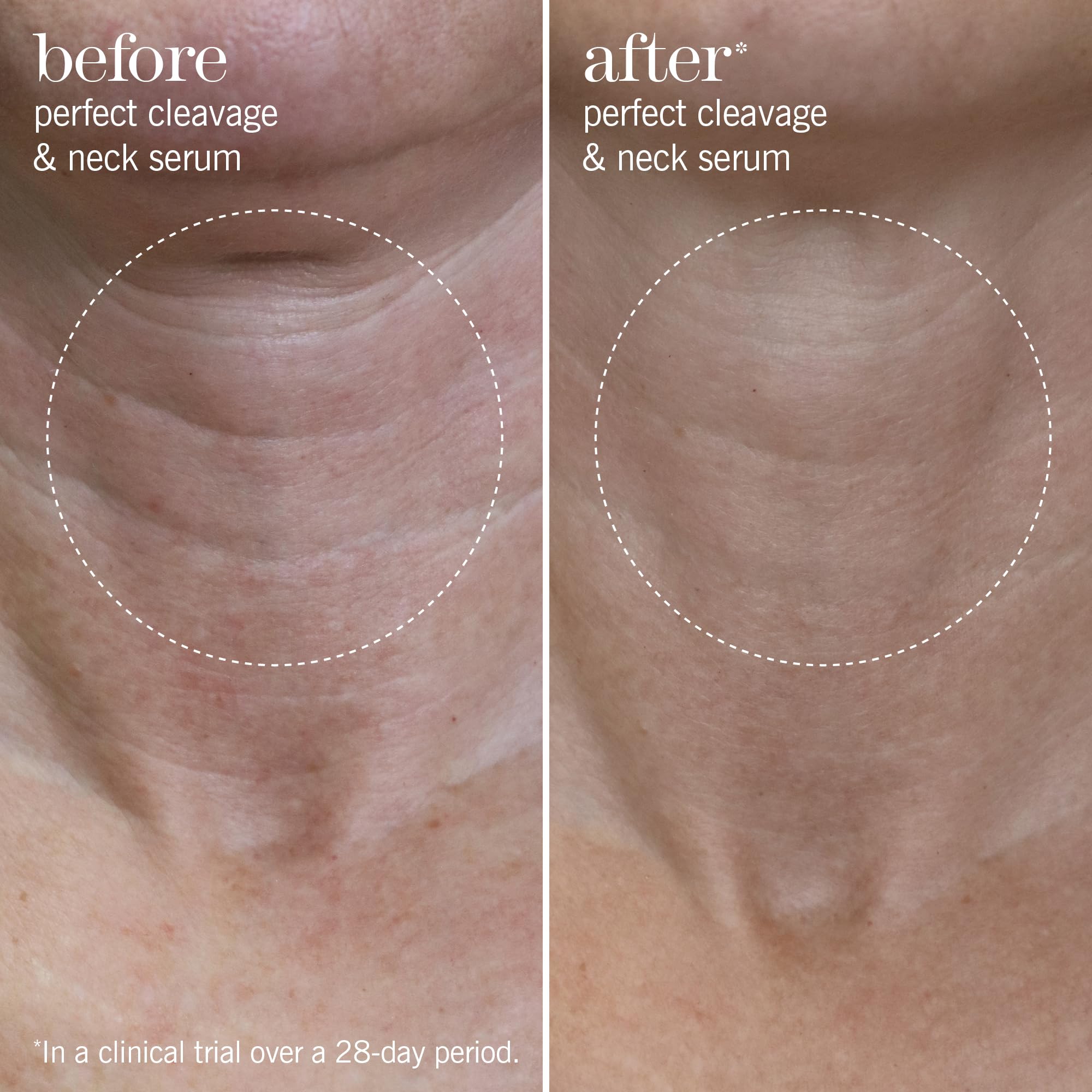 This Works Perfect Cleavage & Neck Serum, 150 ml, hidratante antienvejecimiento para cuello y escote con algas marinas y ácido hialurónico, crema de cuello que estimula la juventud con aceites