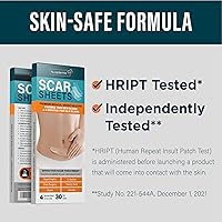 Vista 9 de NUVADERMIS Hojas de silicona para cicatrices – Hojas de cicatrices extra largas para cesáreas, abdominoplastia, queloides y cicatrices quirúrgicas