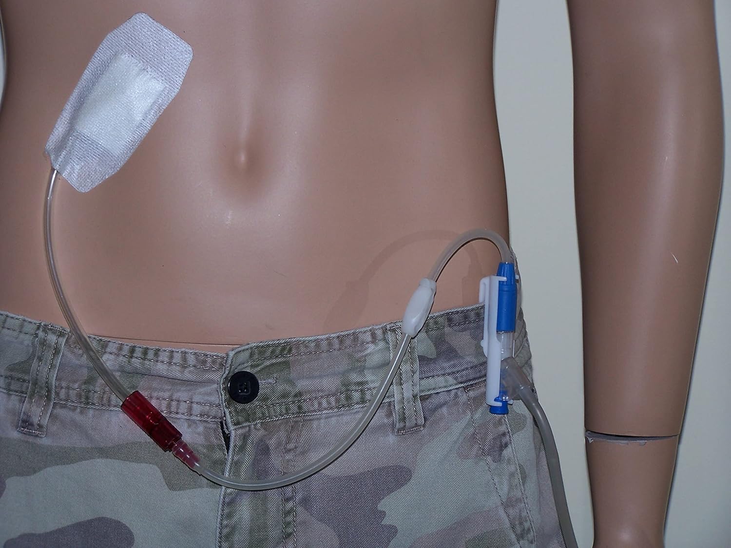 Secureway Peritoneal Dialysis PD Catheter Holders. Type Fresenius, Day Shower Holder and Night Exchange Holder, White