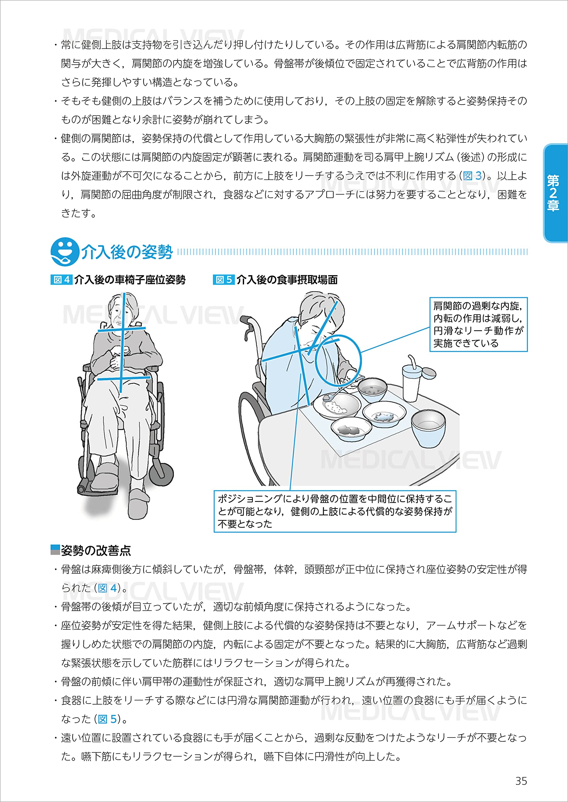 姿勢を意識した 神経疾患患者の食べられるポジショニング 森若 文雄 内田 学 配送料無料