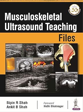 MUSCULOSKELETAL ULTRASOUND TEACHING FILES