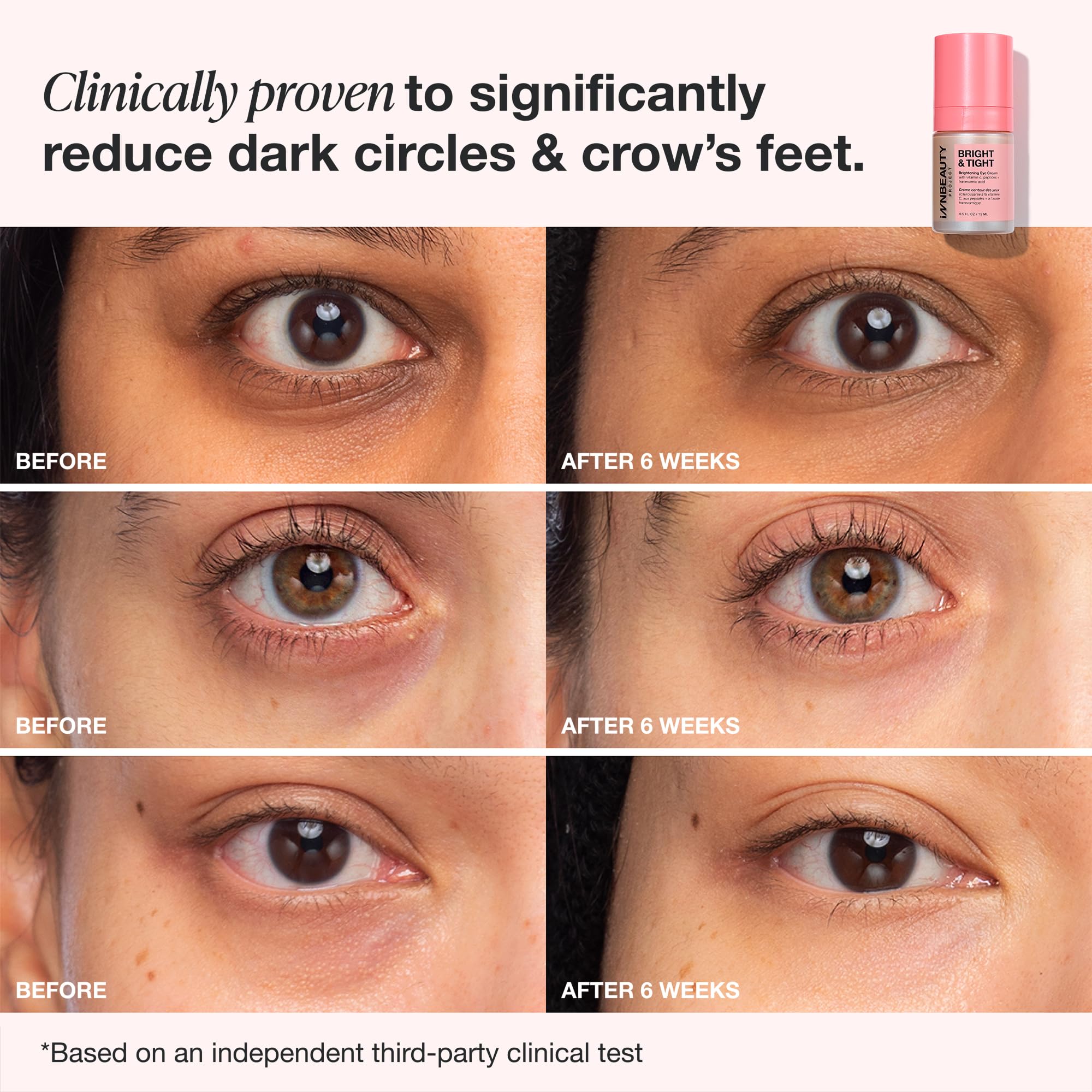Amazon.com: Innbeauty Project Bright & Tight Eye Cream with