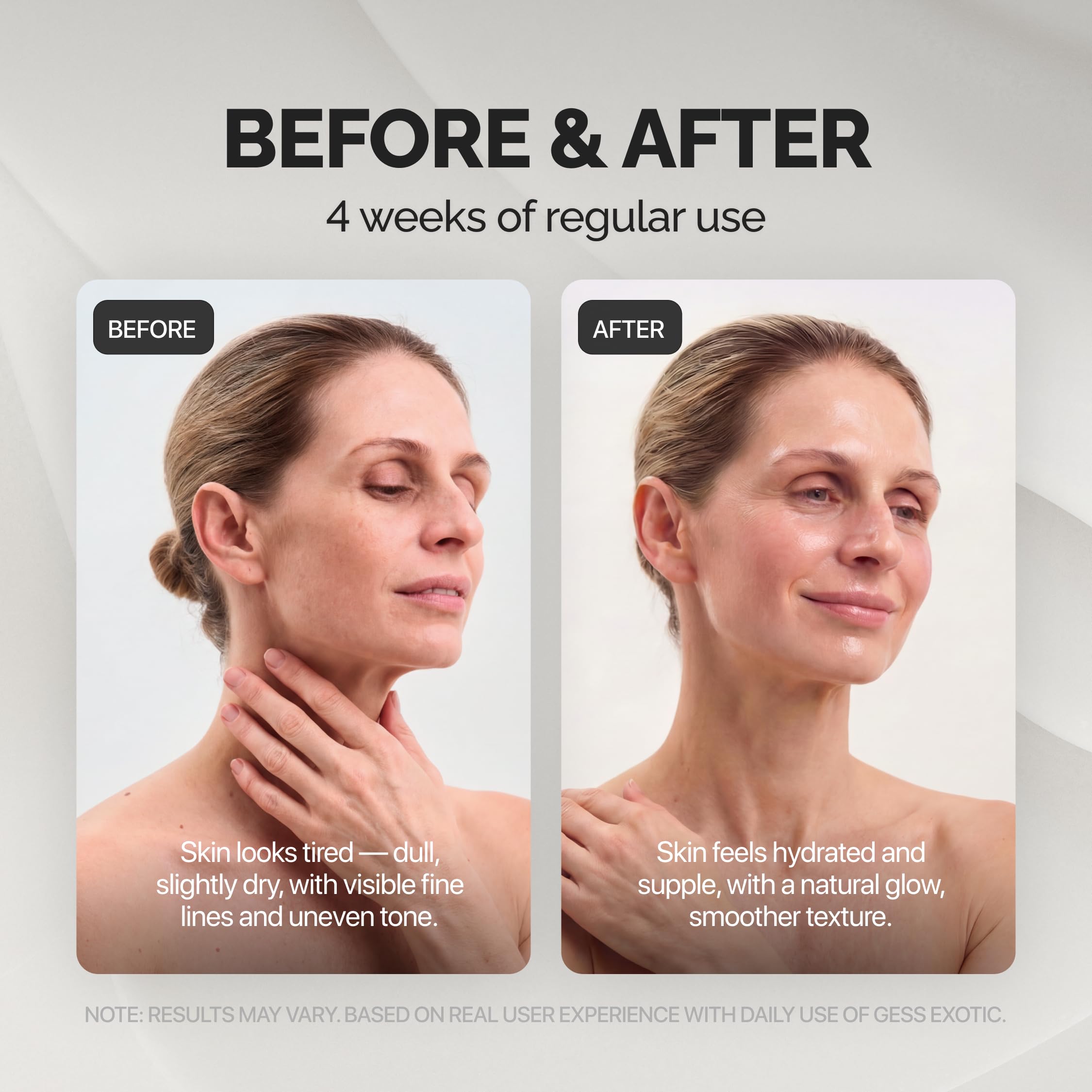 GESS Exotic Ultraschall-Gesichts-Lifting-Gerät - sanftes Peeling, Hautstraffung, Anti-Aging Pflege-System für trockene & reife Haut mit Chromotherapie und Videoanleitung