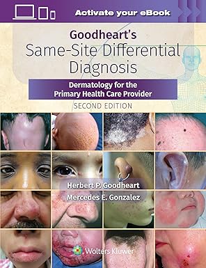 Goodheart's Same-Site Differential Diagnosis: Dermatology for the Primary Health Care Provider-Wow! eBook