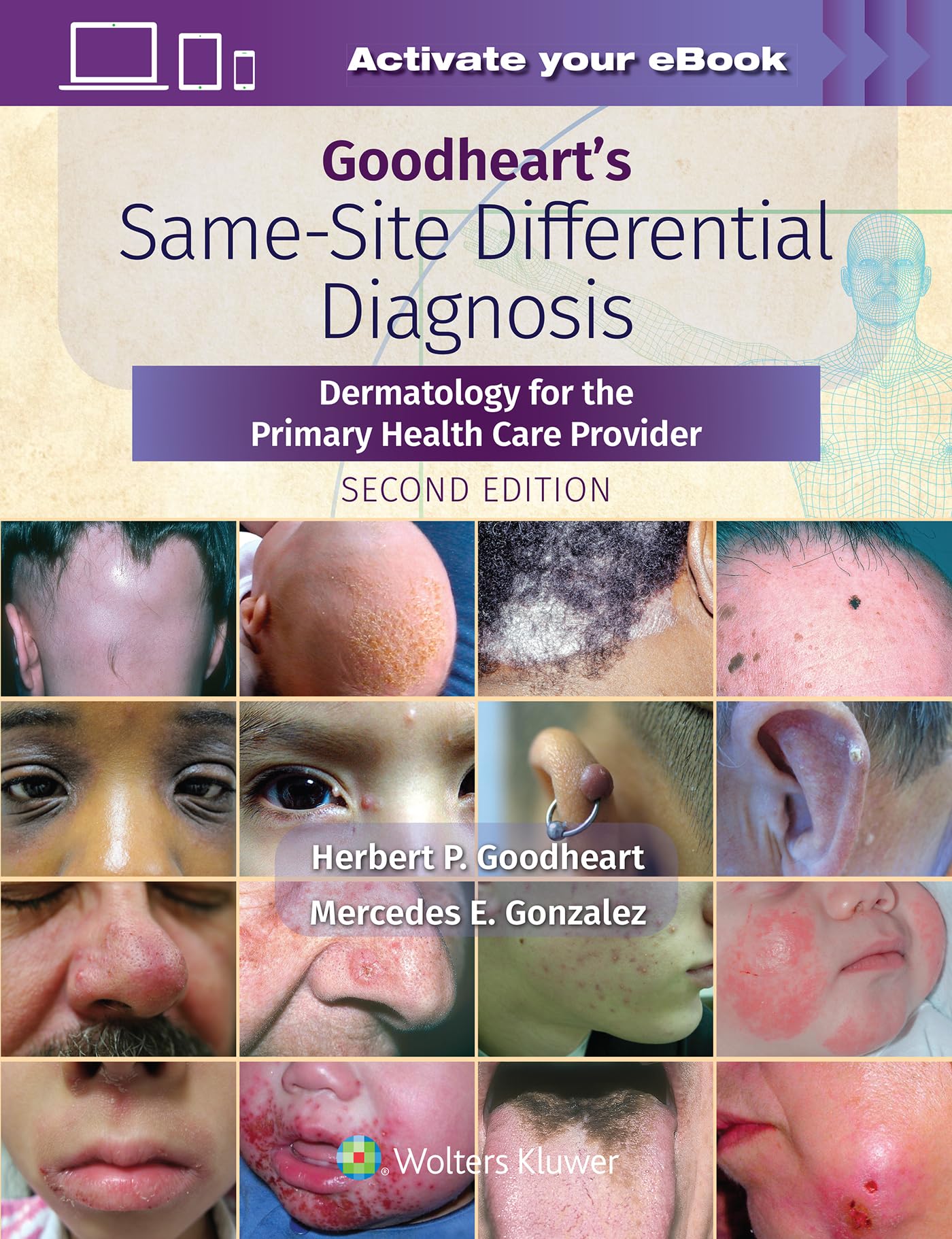 Goodheart's Same-Site Differential Diagnosis by Herbert Goodheart