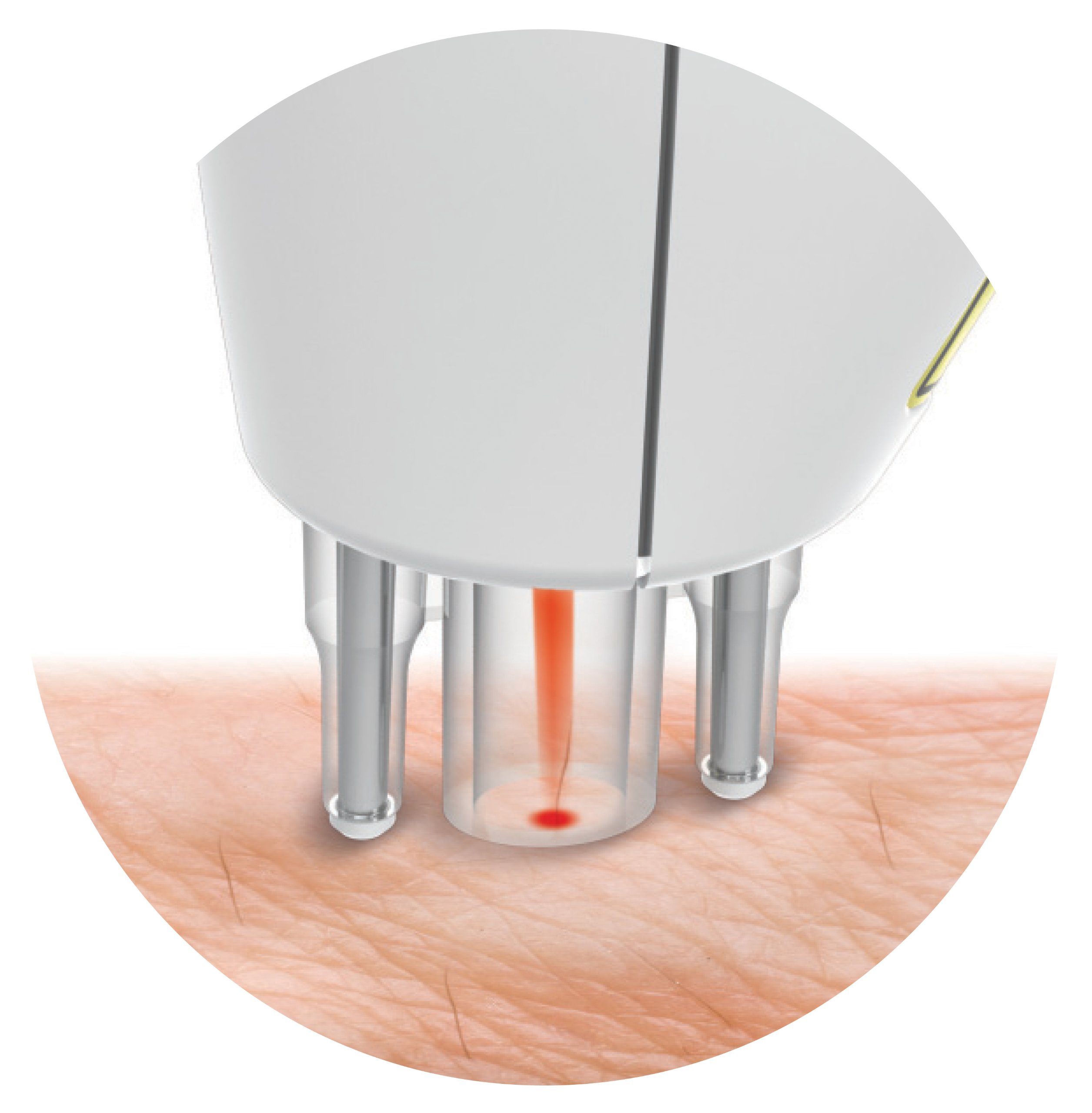Rio Salon Laser Tweezer - Depiladora láser
