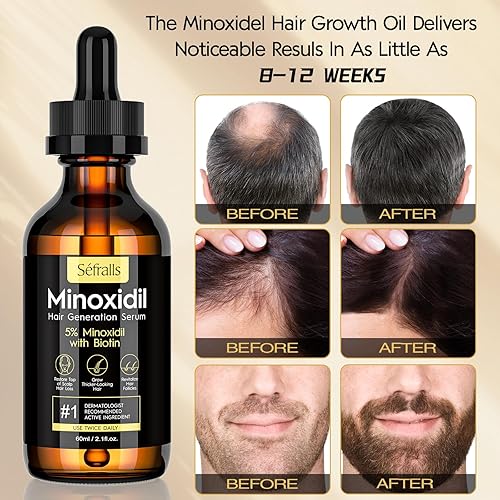 Miniatura 3 de Kit de aceite de crecimiento del cabello de minoxidil al 5% para hombres y mujeres, suero de crecimiento extra fuerte, suero tópico para tratamiento
