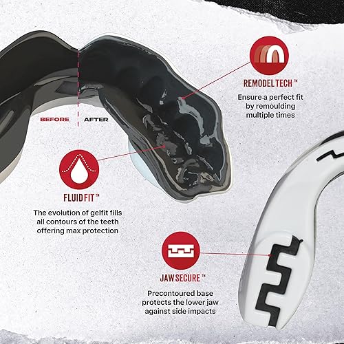 Miniatura 9 de SAFEJAWZ - Protector bucal de corte delgado para adultos y jóvenes, con estuche, ideal para boxeo, baloncesto, lacrosse, fútbol, MMA, artes