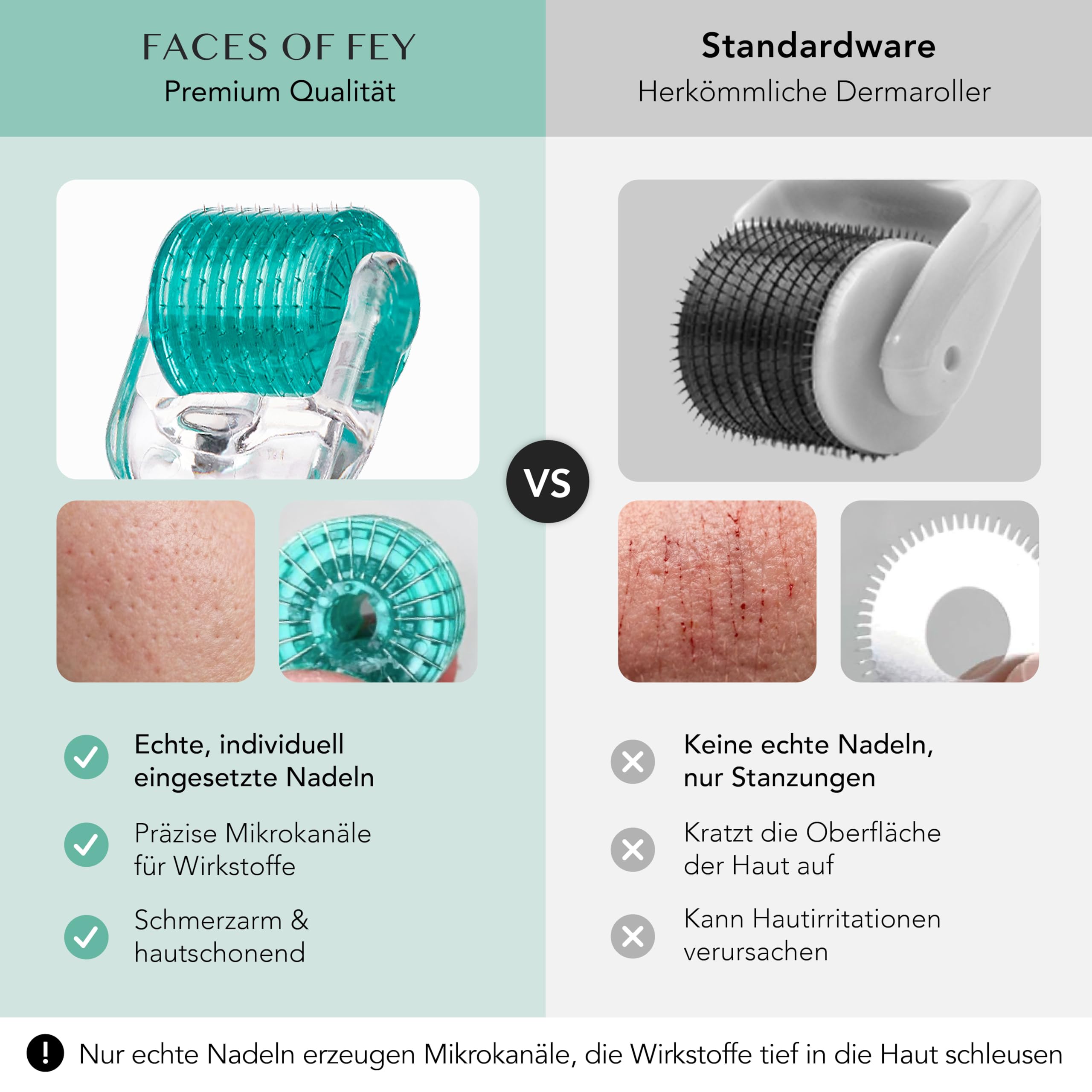 FACES OF FEY Dermaroller Gesicht 0,5mm – 192 Echte Nadeln aus Chirurgenstahl – Microneedling Roller für Gesicht & Körper – Derma Roller für professionelles Micro Needling zuhause