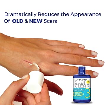 Triple Action Scar Treatment .5oz