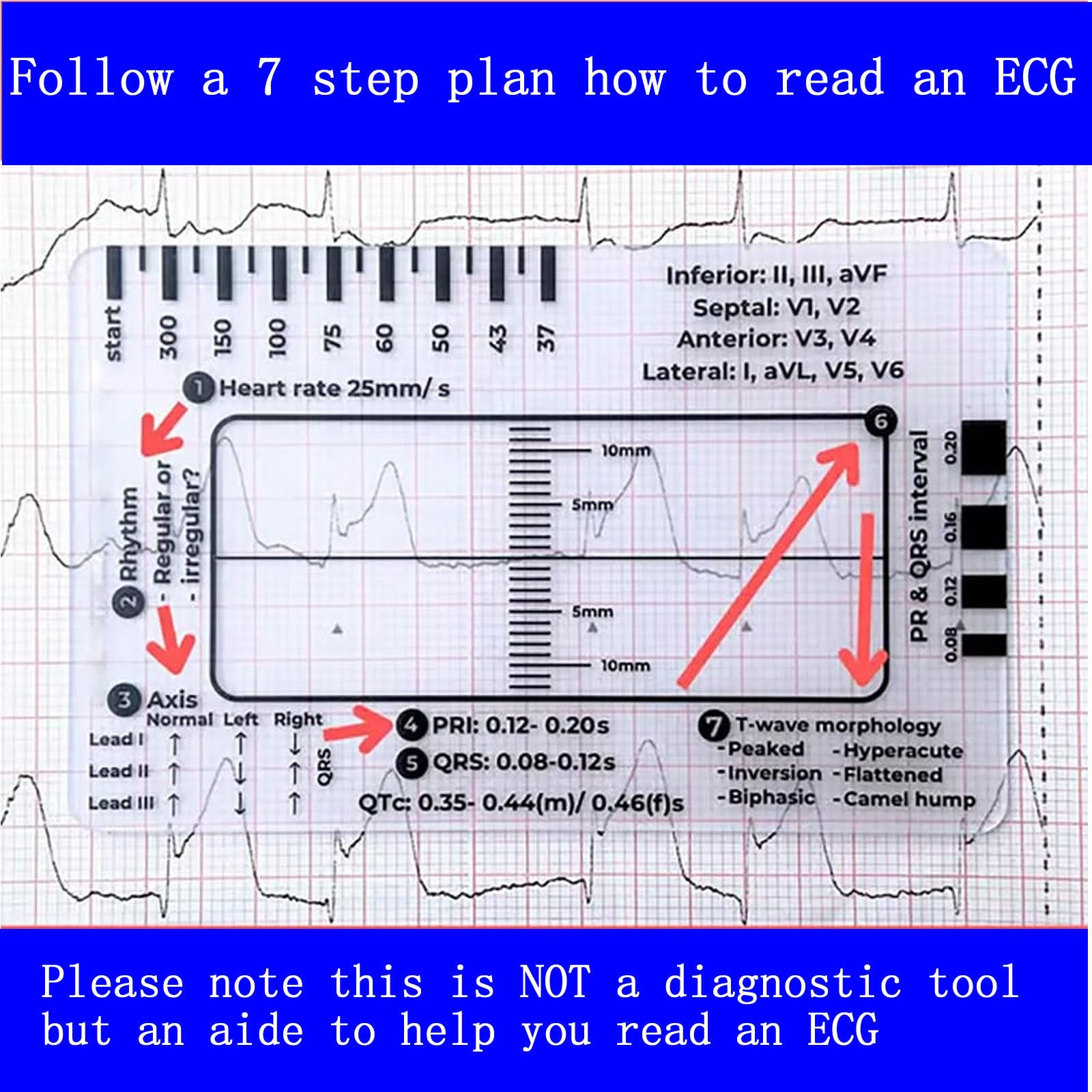 ECG Ruler - 7 Step EKG Interpretation Guide -2