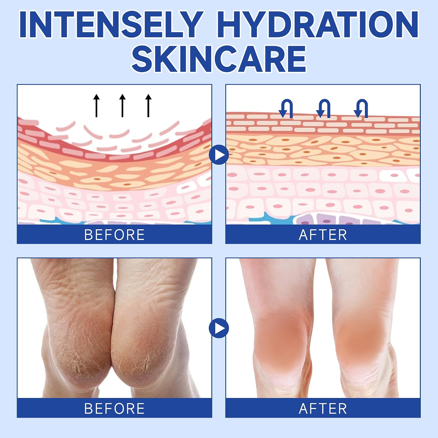 Urea Cream 60 Percent For Feet Maximum Strength - Intensive Repair Dry Cracked Skin, Urea Cream For Foot, Foot Cream For Dry Cracked Heels and Feet, 2 Pcs - 1.41 Oz