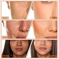 Vista 8 de 4 en 1 Dermoabrasión de diamante Microdermabrasión Limpiador de la piel Vacío Facial Peeling Rociador Blackhead Removedor de acné Cuidado de la piel