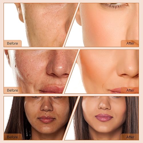 Miniatura 8 de 4 en 1 Dermoabrasión de diamante Microdermabrasión Limpiador de la piel Vacío Facial Peeling Rociador Blackhead Removedor de acné Cuidado de la piel