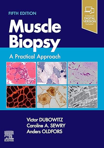 Muscle Biopsy: A Practical Approach